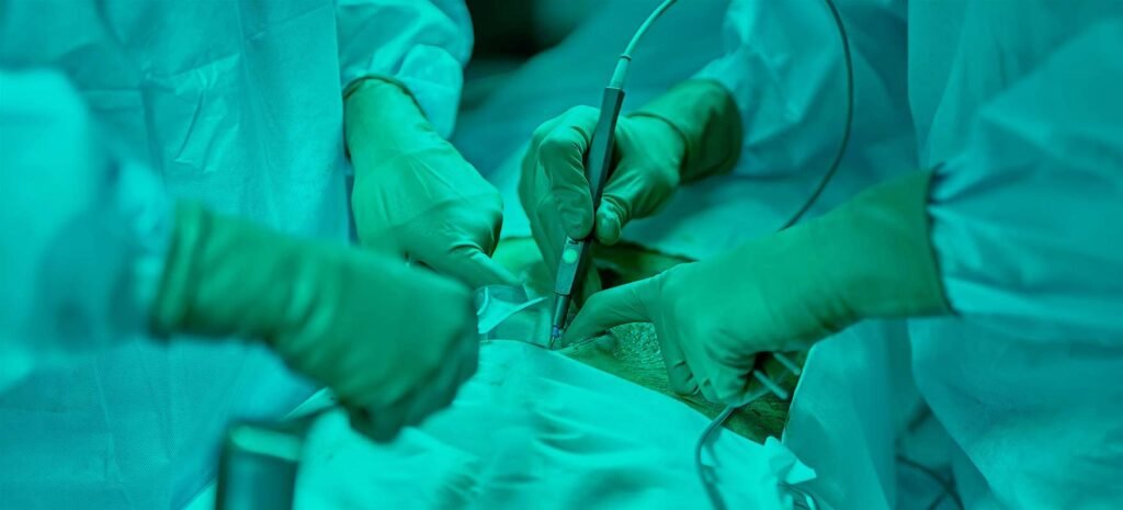 Bariatric Surgery