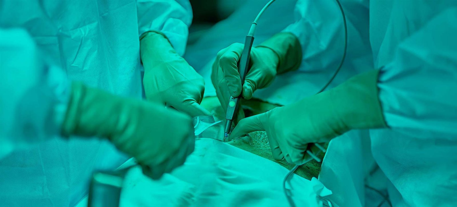 Bariatric Surgery