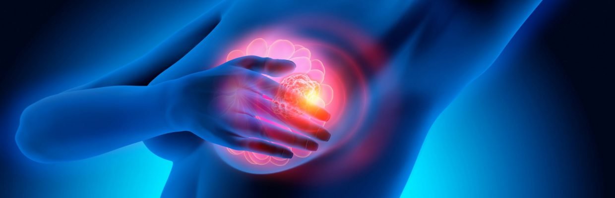 Breast Surgery
